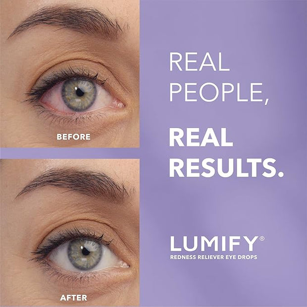 LUMIFY Redness Reliever Eye Drops, 0.25 Fl (7.5 mL)