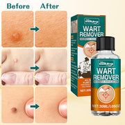 Fast Action Liquid Wart Remover Natural