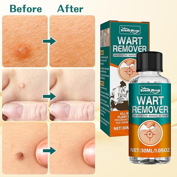 Fast Action Liquid Wart Remover Natural